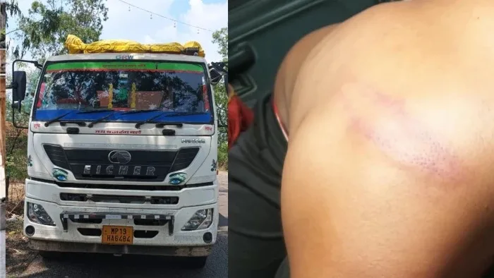 कुत्ते की मौत बनी विवाद की वजह! बंदूकधारियों ने ट्रक ड्राइवर को पीटा, जंगल में भागकर बचाई जान ...