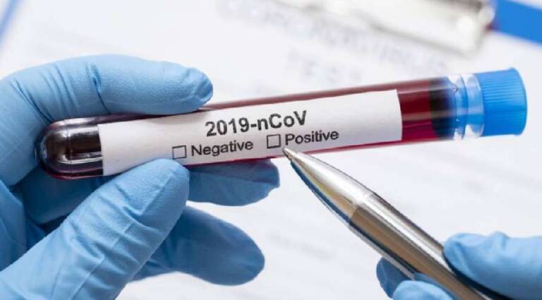 coronavirus1