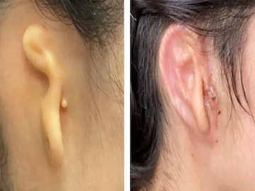 3D-EAR-16542316694x3