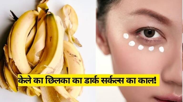 1613292-banana-peels