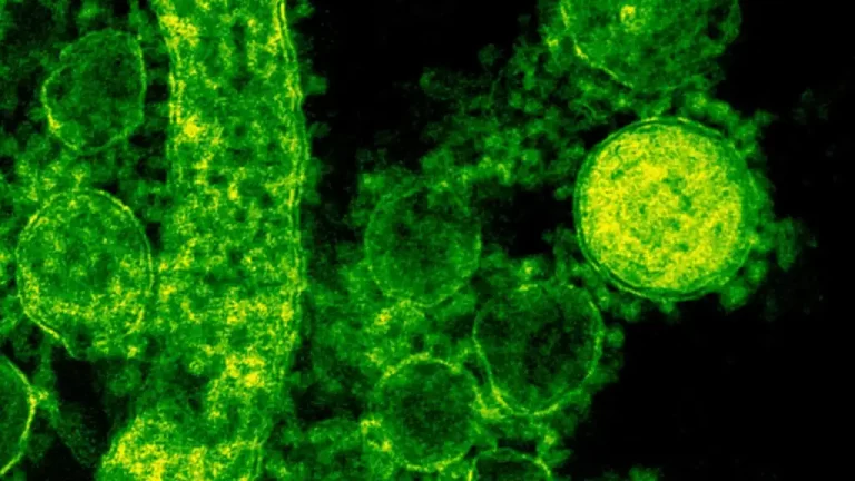 Bacteria-pexels