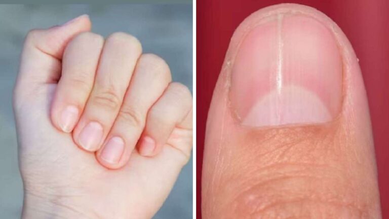 _Nakhun Par Aadhe Chand ka Matlab (1)