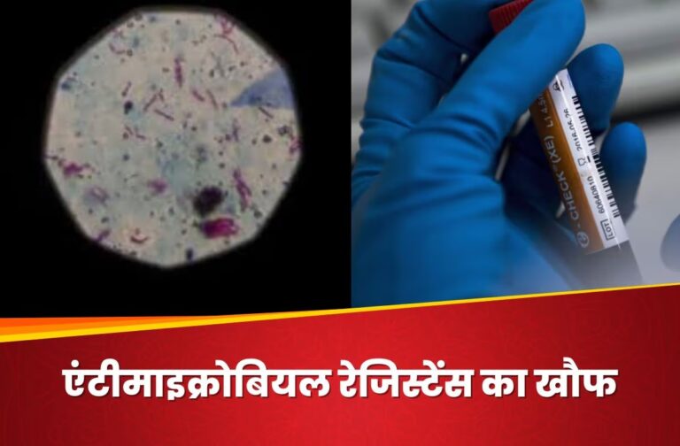 antimicrobial-resistance