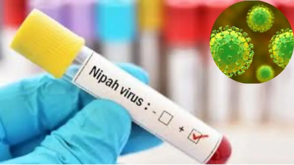 nipah-virus-2096711618