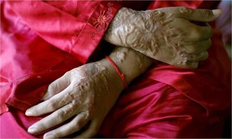 2026_4image_10_40_444974672acidattack-ll