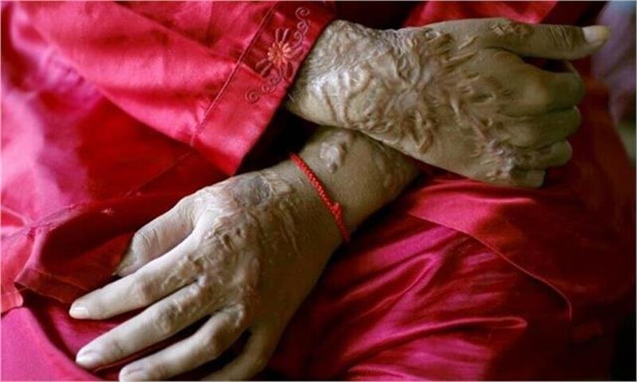 2026_4image_10_40_444974672acidattack-ll